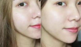 美容院祛斑爆料视频大全,视频大全深度解析