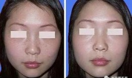 美容院祛斑爆料视频大全,视频大全深度解析